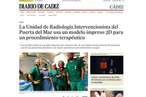 Modelos 3D usados por la Unidad de Radiología Intervencionista del Hospital Puerta del Mar en Cádiz
