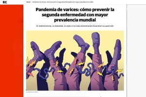 Varices - Cómo prevenirlas y tratarlas con Radiología Vascular Intervencionista