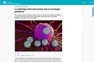 La radiología intervencionista avanza notablemente en el campo de la oncología pediátrica