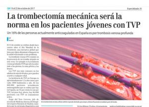 Trombectomía mecánica para la Trombosis Venosa Profunda (TVP-  Día Mundial de la Trombosis