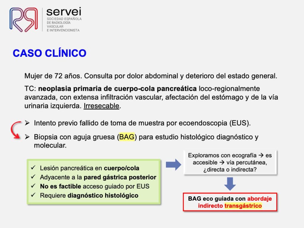 Biopsia pancreatica transgastrica_06