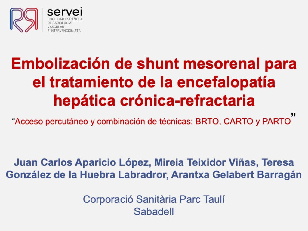 Embolizacion shunt mesorenal_01