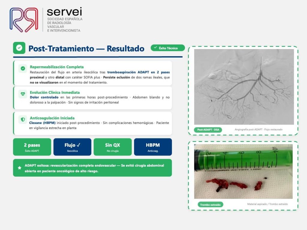 Isquemia mesenterica tecnica ADAPT_06