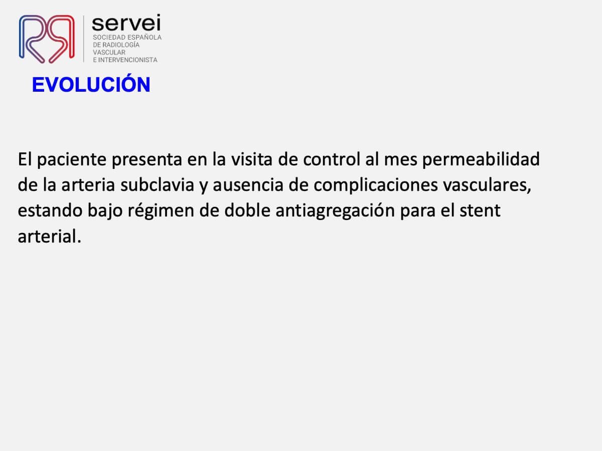 Manejo multidisciplinar malposicionamiento arterial marcapasos_08