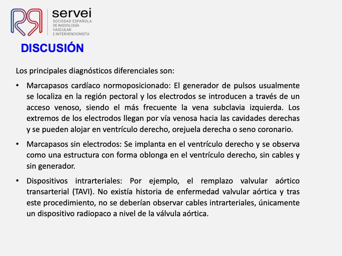 Manejo multidisciplinar malposicionamiento arterial marcapasos_10