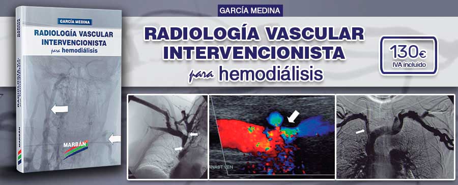 radiologia-vascular-intervencionista-hemodialisis