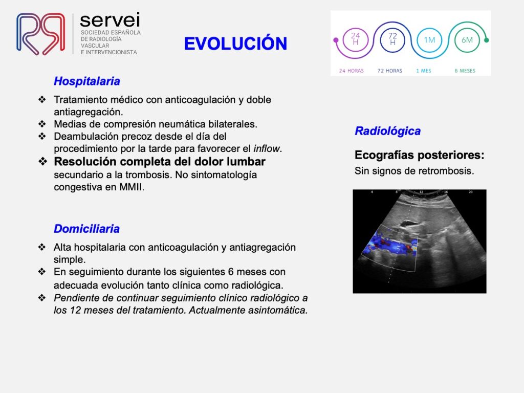 Trombectomia-mecanica-tvp-dolor-lumbar_09