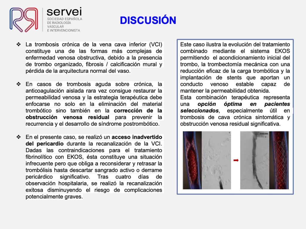 Trombectomia-mecanica-tvp-dolor-lumbar_10