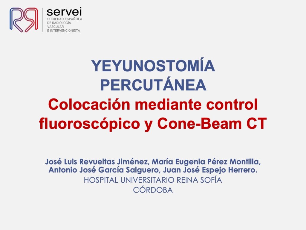 Yeyunostomia percutanea_colocacion_01