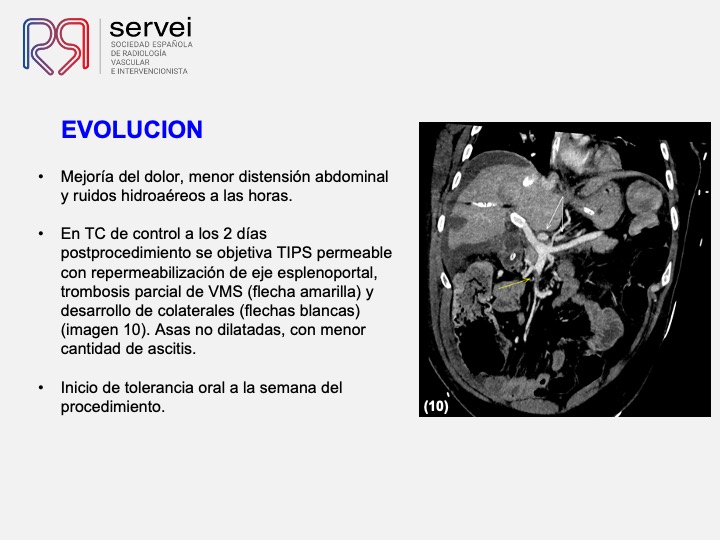 Isquemia mesenterica venosa 07