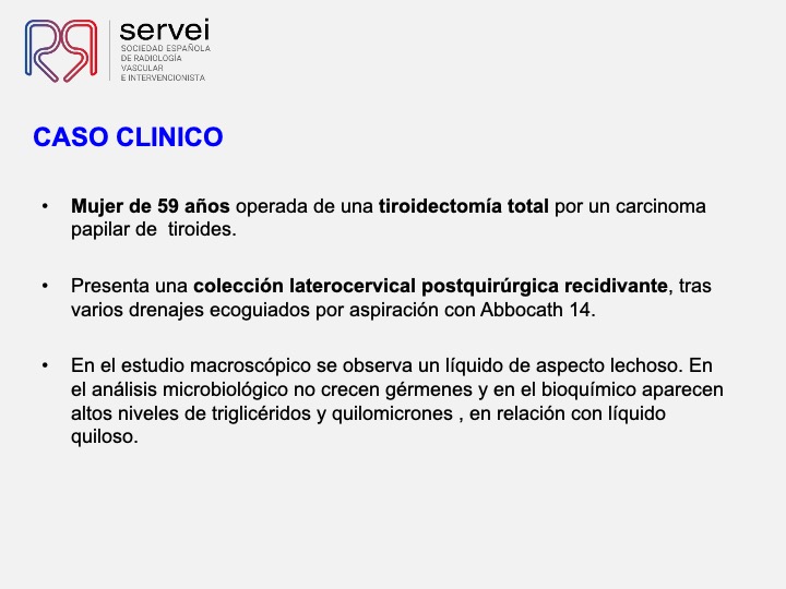 Embolizacion conducto toracico 02