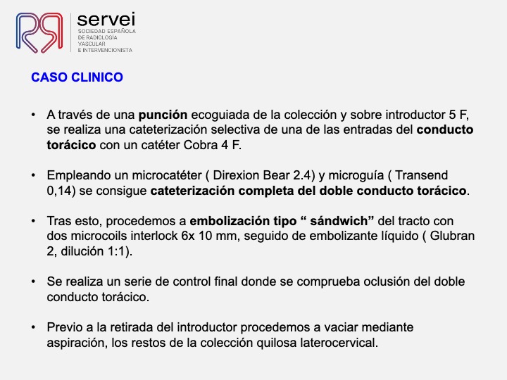Embolizacion conducto toracico 05