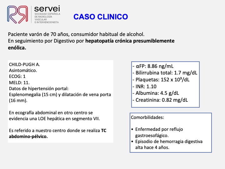 Radioembolizacion hepatocarcinoma estadio inicial 02