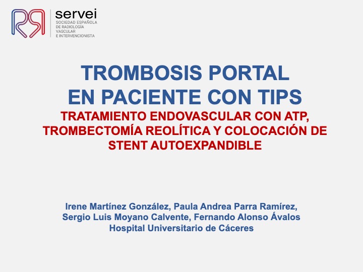 Trombosis portal en paciente con TIPS 01