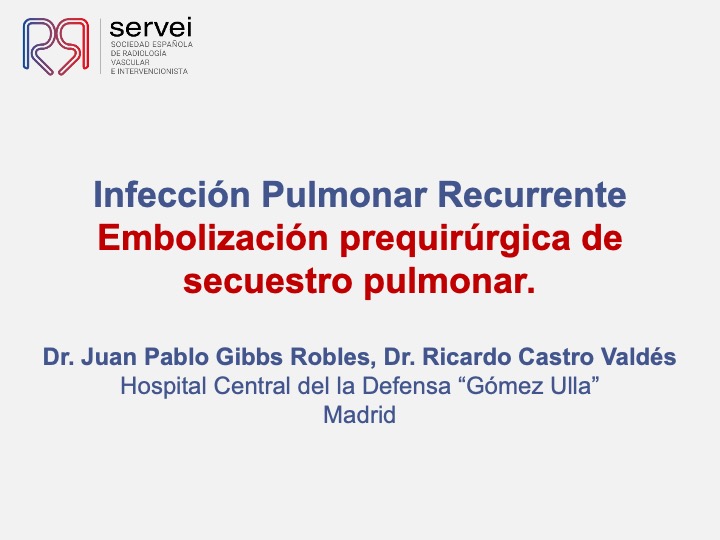 Embolizacion por infeccion pulmonar 01