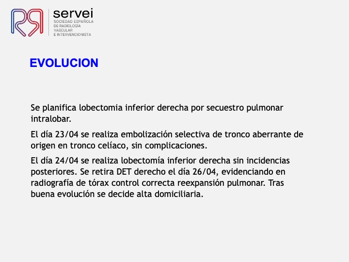 Embolizacion por infeccion pulmonar 06