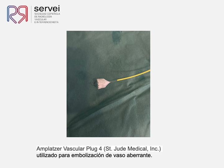 Embolizacion por infeccion pulmonar 10