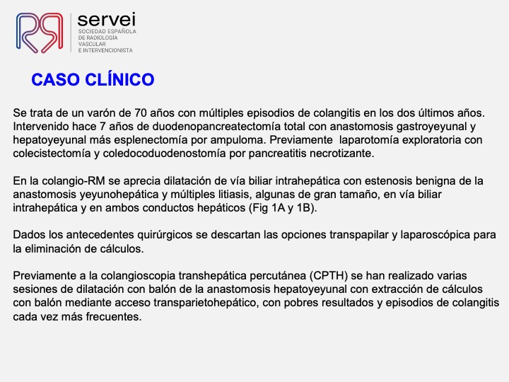 Tratamiento percutaneo litiasis biliar 02