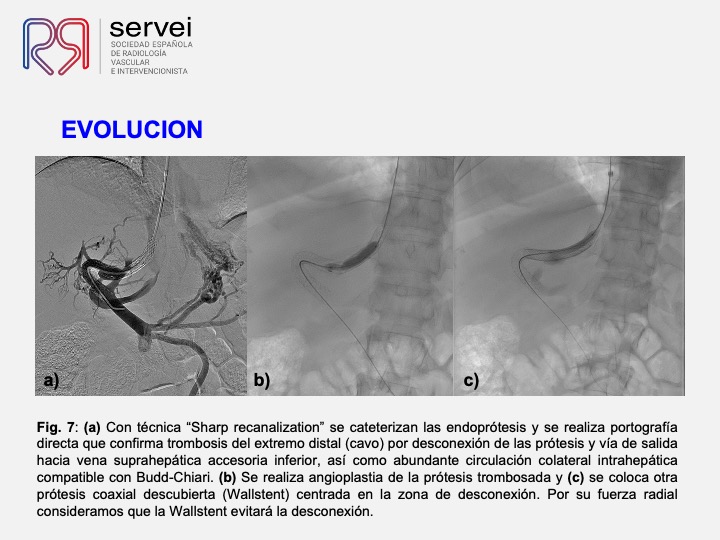 DIPS tecnica gun-sight 09