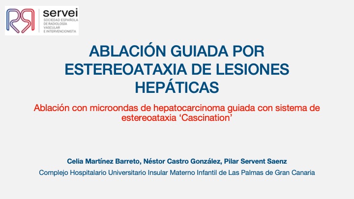 Ablacion estereoataxia lesiones hepaticas 01