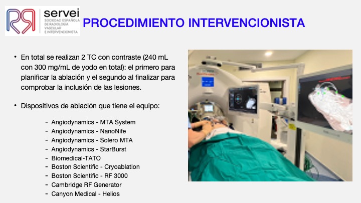 Ablacion estereoataxia lesiones hepaticas 08