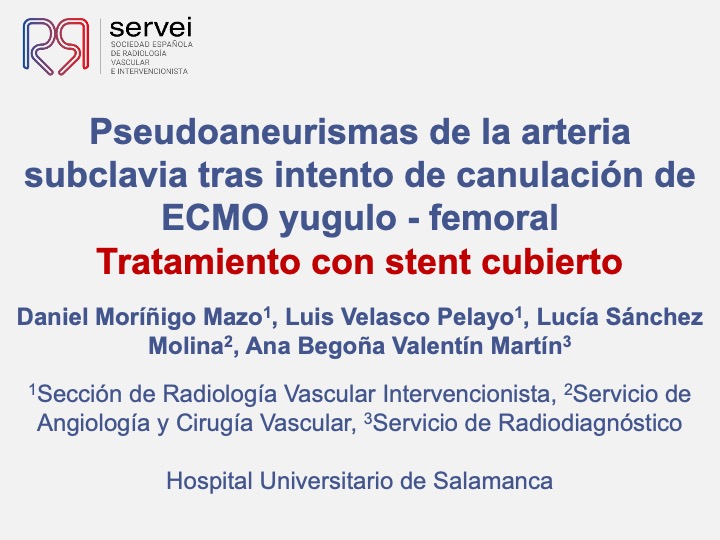 Pseudoaneurismas subclavia stent 01