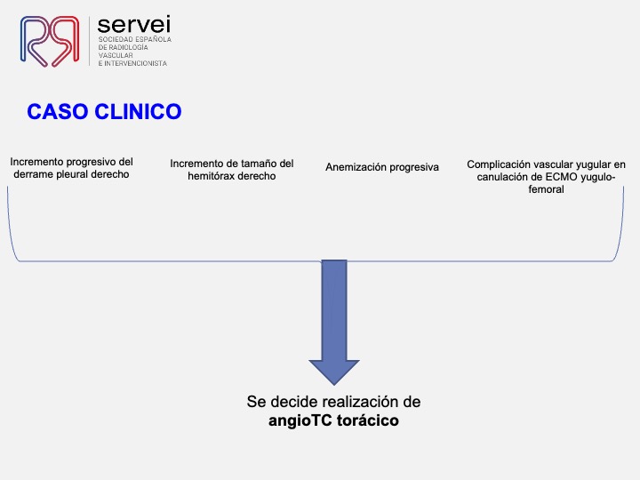 Pseudoaneurismas subclavia stent 04